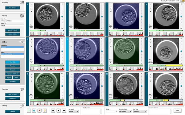 Εμβρυοσκόπηση