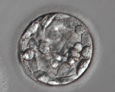 Embryonaltransfer von Blastozysten